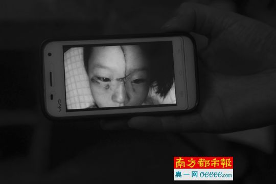 8月26日,受害小女孩包扎前所拍攝的樣貌。實習生