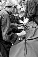 1、醫生在給曉越手術,從他體內取出1米多長的鋼筋